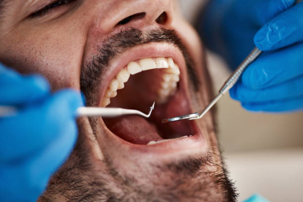 Best Same-Day Emergency Dentist in Amelia Court House, VA