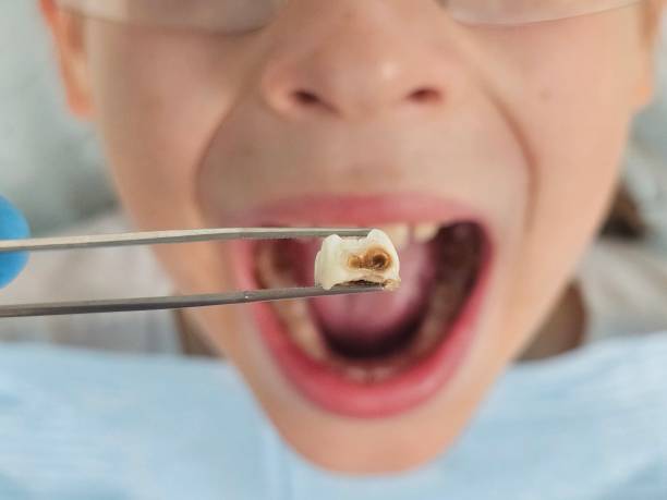 Best Emergency Broken Tooth Repair in Amelia Court House, VA